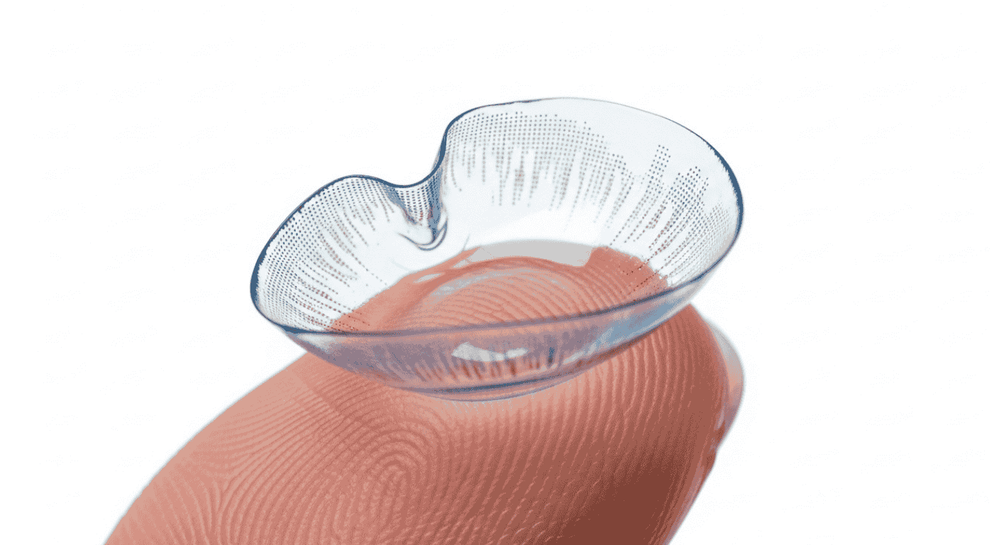 distorted shape torn contact lenses