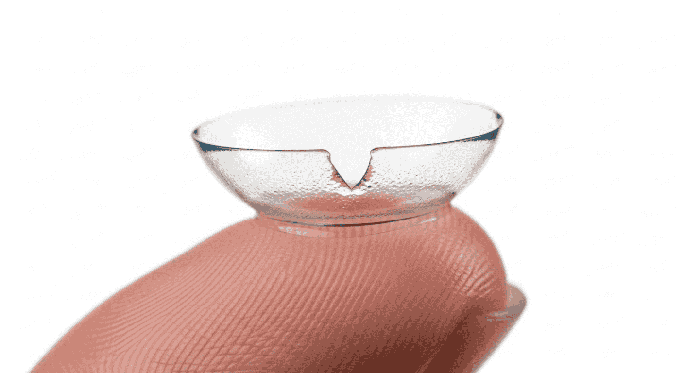 jagged or uneven edge torn contact lenses